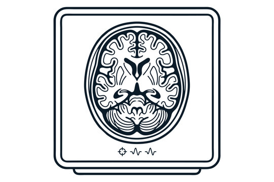 Medical Brain Scan MRI on Monitor Screen
