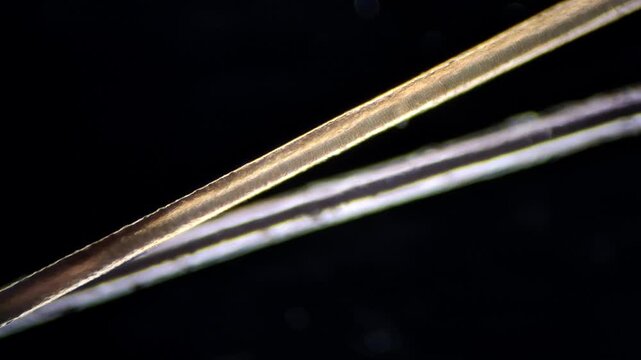 Microscopic view of human hair shaft and dandruff flakes under darkfield illumination.