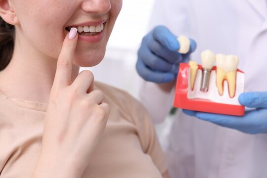 Doctor showing dental implant model to woman in clinic, closeup