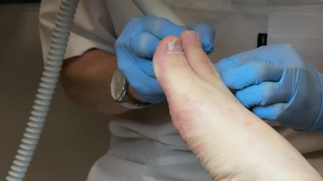 Close-up man foot pedicure diamond drill master wearing blue gloves working on toenail electric file smoothing callus salon lamp