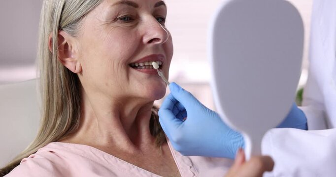 Doctor choosing dental implant color with woman at clinic, closeup