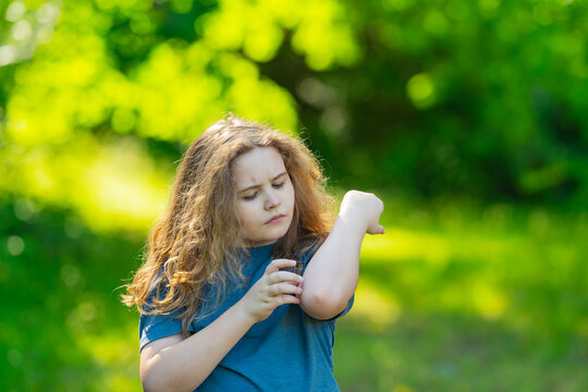 Itching child scratches irritated skin. Itching arm shows discomfort. Itching rash after insect bite. Itching skin on kid.