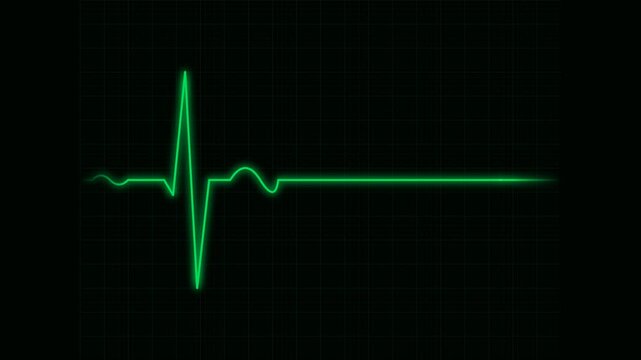 Heartbeat flatline electrocardiogram continuous hospital green wave animation on dark electronic monitor interface 4K