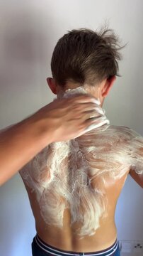 Sunburned boy at home applying ointment to back, back view
