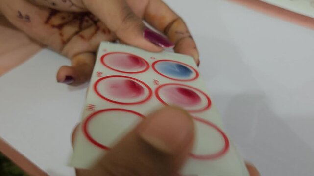 ABO and Rh blood grouping slide agglutination test performed in clinical laboratory. Blood samples mixed with antisera on a blood typing card for determining ABO and Rh (D) blood groups