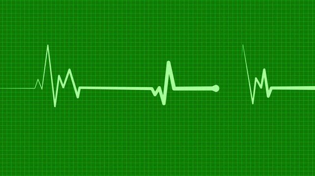 Health heartbeat line medical ekg rhythm pattern health monitor signal and heart activity chart animation
