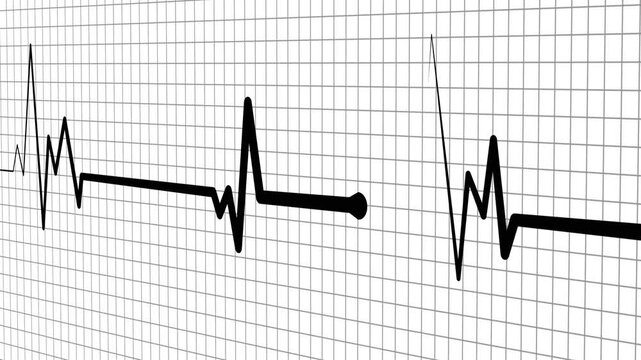 Health heartbeat line medical ekg rhythm pattern health monitor signal and heart activity chart animation