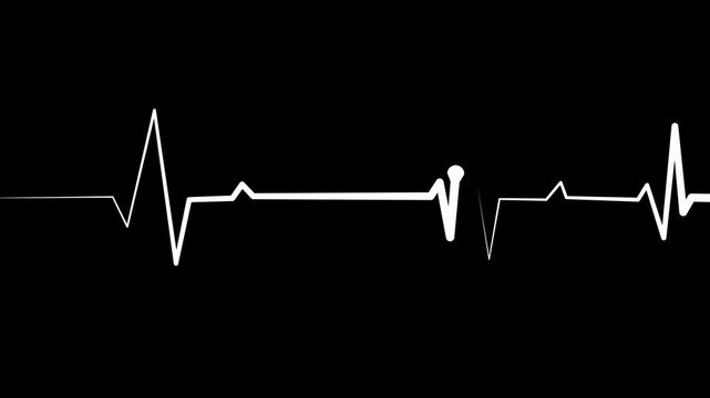 Medical heartbeat line on graph paper with a medical monitor style wave animation