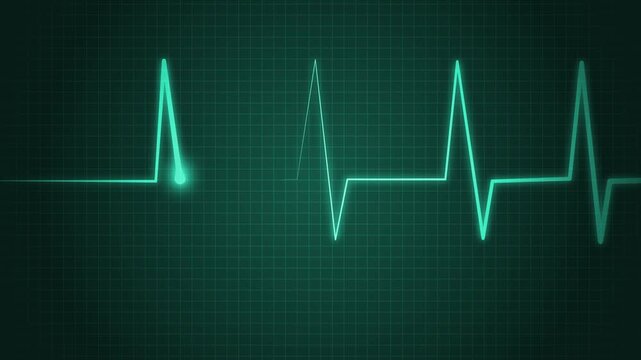 Ecg heart rhythm line on graph paper showing pulse spikes and flat line animation