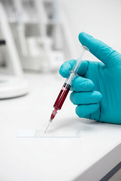 Blood sample application onto microscope slide for laboratory diagnostics