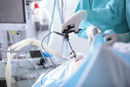 Laparoscopic surgery. Modern abdominal surgery. Surgical intervention through small holes. Penetration into abdominal cavity. Team of surgeons