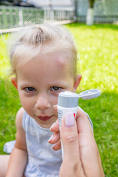 Applying soothing cream to a mosquito bite on a little girl's forehead