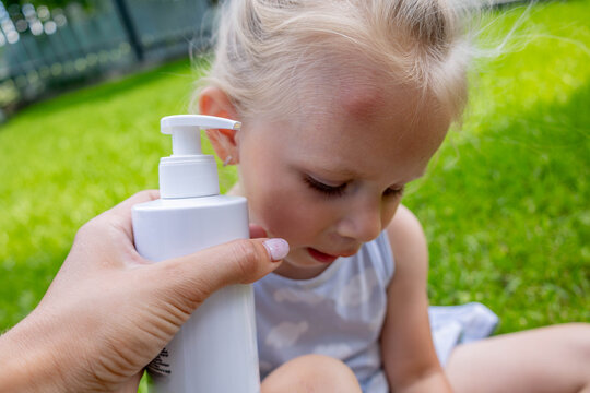 Applying soothing cream to a mosquito bite on a little girl's forehead