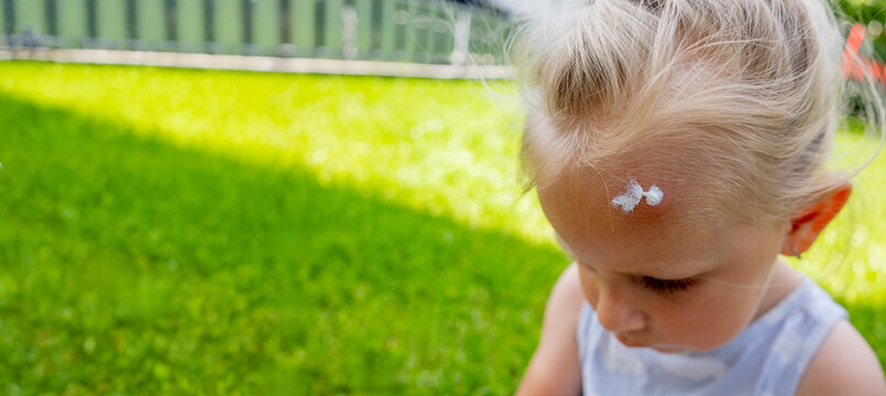Applying soothing cream to a mosquito bite on a little girl's forehead