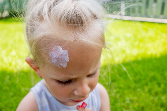 Applying soothing cream to a mosquito bite on a little girl's forehead