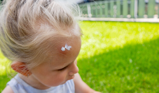 Applying soothing cream to a mosquito bite on a little girl's forehead