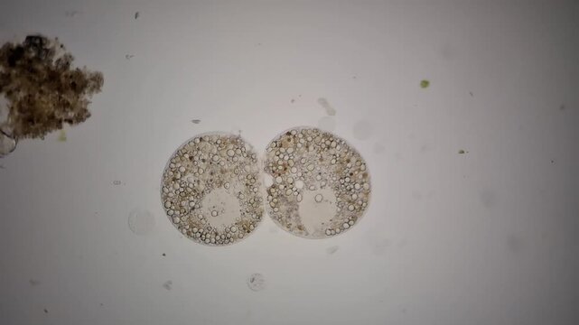 Microscopy of testate amoeba undergoing binary fission cell division 