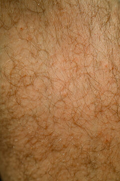 Close-up View of Skin With Hair on Body Showing Details and Texture