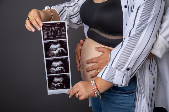 Pregnant big belly holding a ecography sonography baby scan