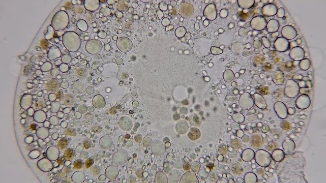 Microscopic view of a testate amoeba with a ruptured test 