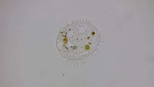 Microscopic view of Euplotes ciliate protist single cell organism