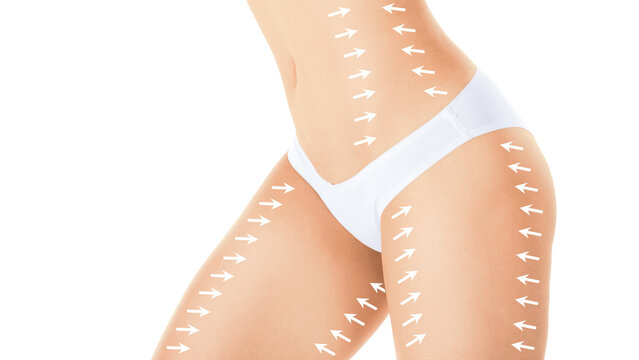 Slim female hips and belly in white pants with correction arrows on areas for aesthetic medicine intervention, isolated on white background.