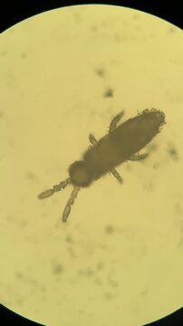 Microscopic View of Springtail Insect Specimen