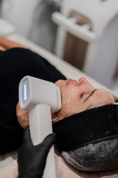 Client lying on a treatment bed getting laser treatment on her face