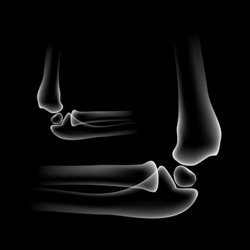 Human elbow joint skeleton vector illustration isolated on black background. X-ray style side view of elbow bones pair, anatomy humerus radius ulna for medical poster, health care, injury design.