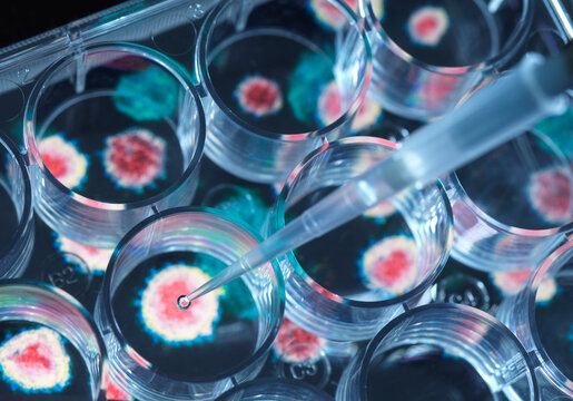 Close-up of pipette placing experimental vaccine into microplate