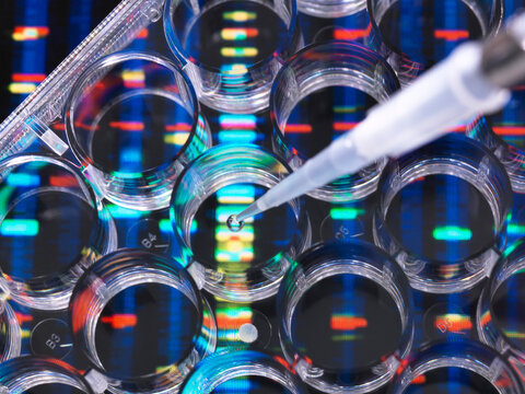 DNA Research, Samples of DNA in a multi well plate ready for analysis with DNA results in the background