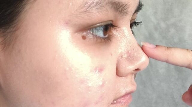 Close up of woman examining her nose, nasal health, ENT medicine, sinus and facial anatomy concept.