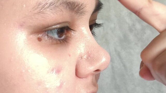 Female hand touching nose after cosmetic procedure concept, rhinoplasty recovery, nasal care and medical aesthetics.