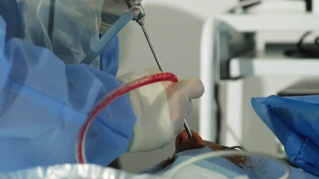 Surgeon hands conduct rhinoplasty operation with medical tools in hospital room closeup. Doctor reshape resize and reconstruct patient nose