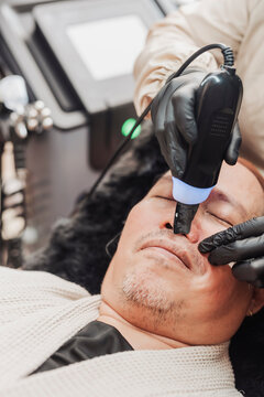 Middle-aged man receiving an ultrasonic skin scrubber facial treatment to deeply cleanse pores, exfoliate dead skin, and improve overall skin texture at a professional aesthetic clinic.