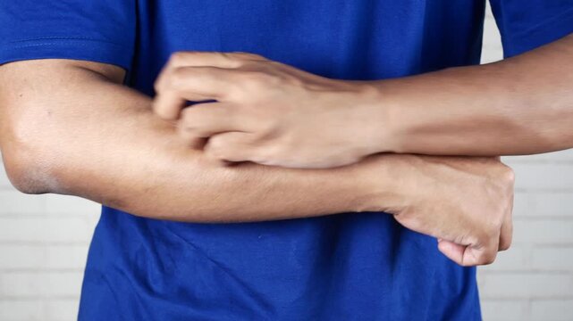 Close-up of a person scratching an itchy arm affected by skin irritation or allergic reaction. Dermatology, eczema, allergy symptoms, skin sensitivity, healthcare, and medical condition concept.