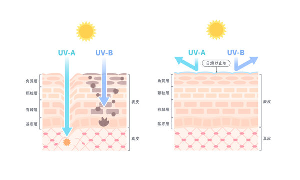 紫外線による肌へのダメージと日焼け止めのUVブロック効果の比較・皮膚構造図解イラスト