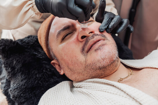 Hydradermabrasion Facial Treatment on the nose area of Middle Aged Man with steamer. He is feeling some discomfort with the procedure.