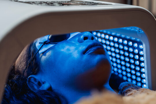 Woman undergoes blue LED light therapy facial while wearing protective eye shields during a professional skincare treatment designed to reduce acne and promote healthier skin.