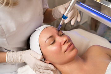 Fototapeta premium Woman undergoing professional microneedling facial skincare procedure for beauty and rejuvenation