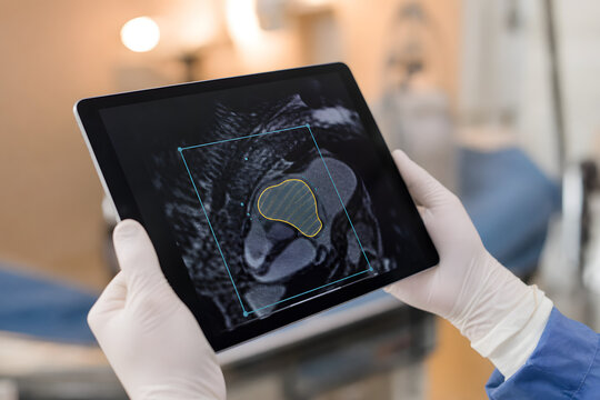 Gloved hands holding tablet with medical scan overlay