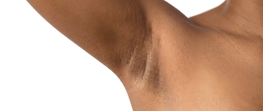 Close up of armpit with dark skin and hair against white background