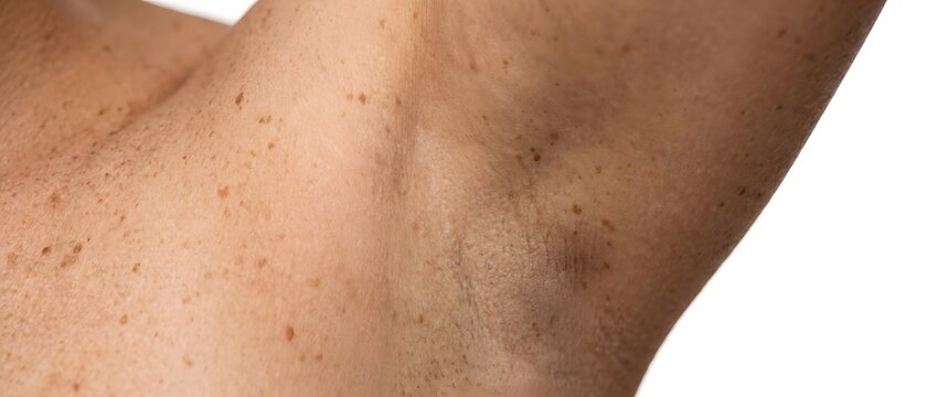 Close up of human armpit skin with texture and small marks