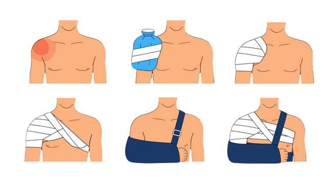 Shoulder injury first aid treatment steps infographic