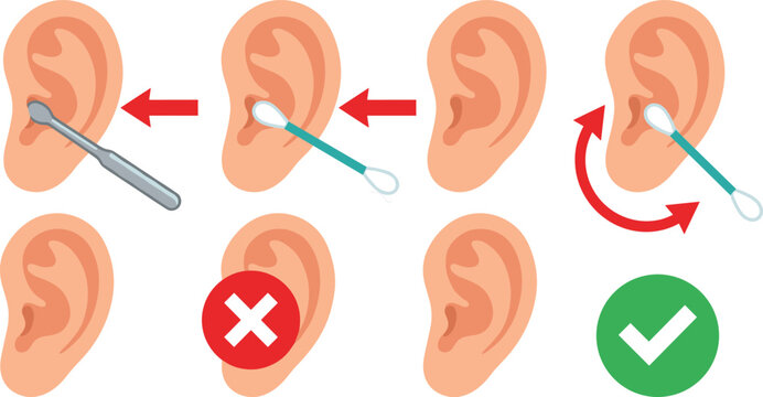 Ear hygiene vector infographic illustration showing the correct and incorrect ways to clean ears using cotton swabs and metallic ear wax removal tools