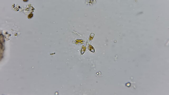 Microscopic view of Diatom algae colony and bacteria in fresh water