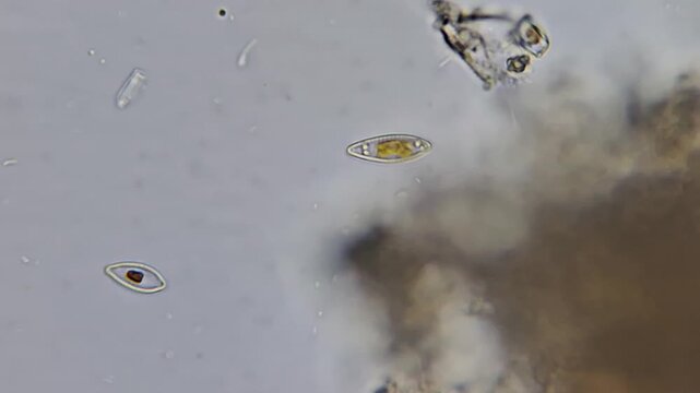 Diatoms and bacteria under the microscope, microbiological interaction and aquatic microorganisms (close up) 