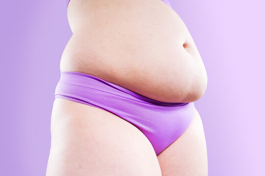 Overweight woman with belly fat in underwear on purple background. Obesity, weight loss, diet and body positivity concept