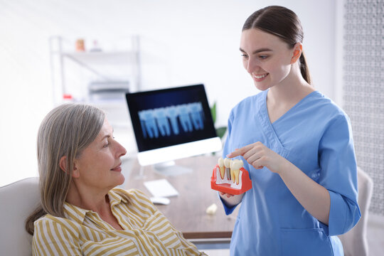 Doctor showing dental implant model to woman in clinic