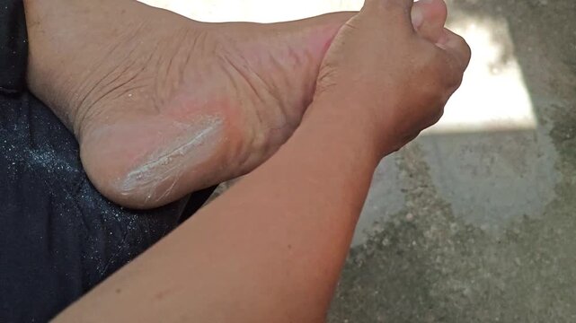 Person giving a manual massage to a tired foot to relieve calluses